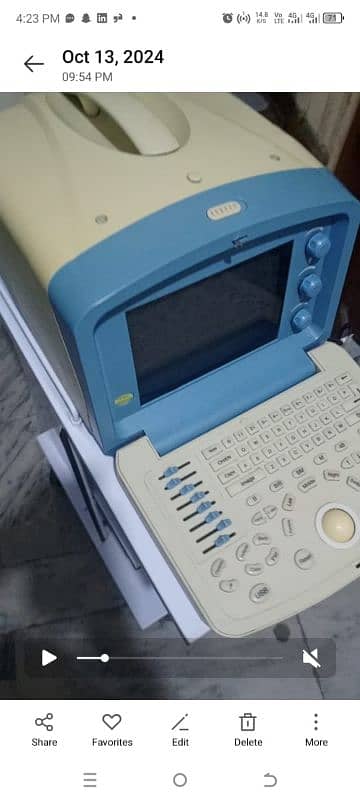 ultrasound machine high resolution portable and printer 6