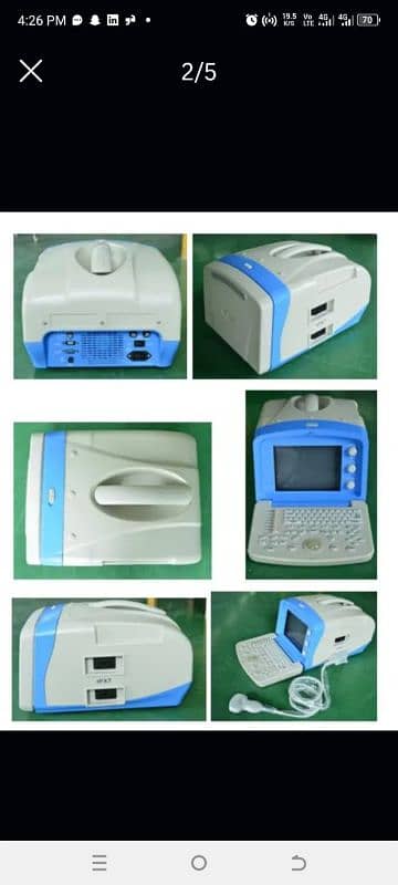 ultrasound machine high resolution portable and printer 0