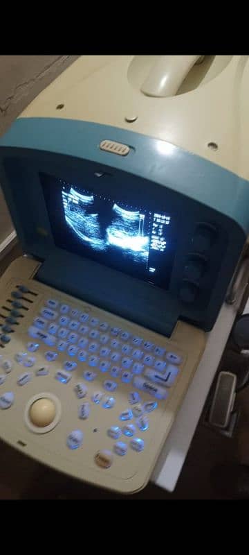 ultrasound machine high resolution portable and printer 1