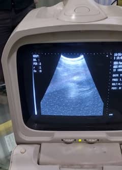 ultrasound machine