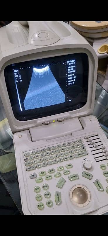 ultrasound machine 3