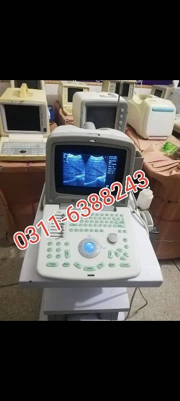 Japanese & China Ultrasound Machine's 1