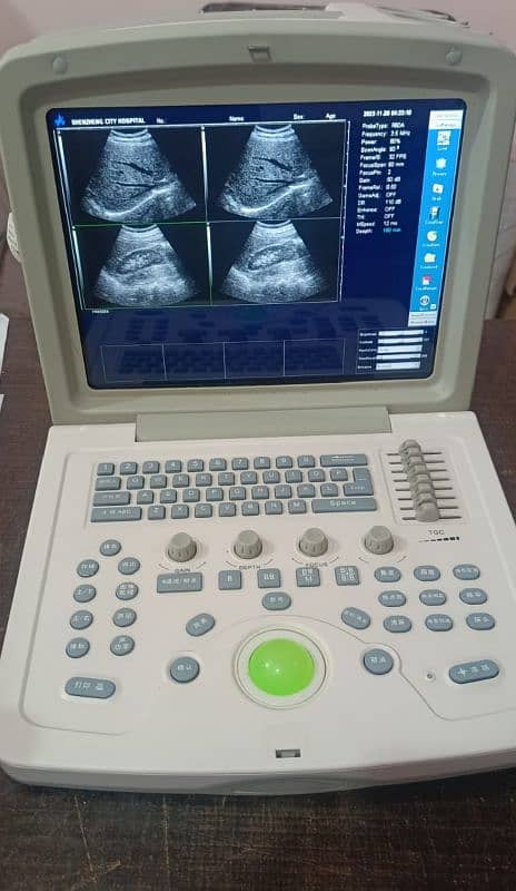 Japanese & China Ultrasound Machine's 2