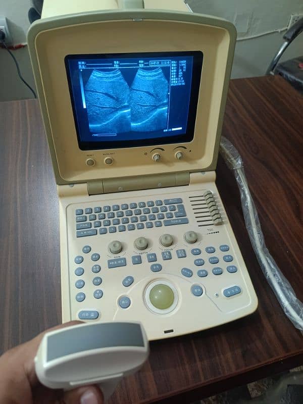 Japanese & China Ultrasound Machine's 19