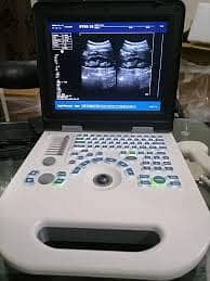 Ultrasound machine Nero 10 1