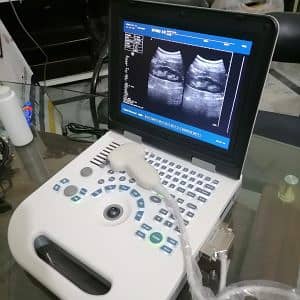 Ultrasound machine Nero 10 3