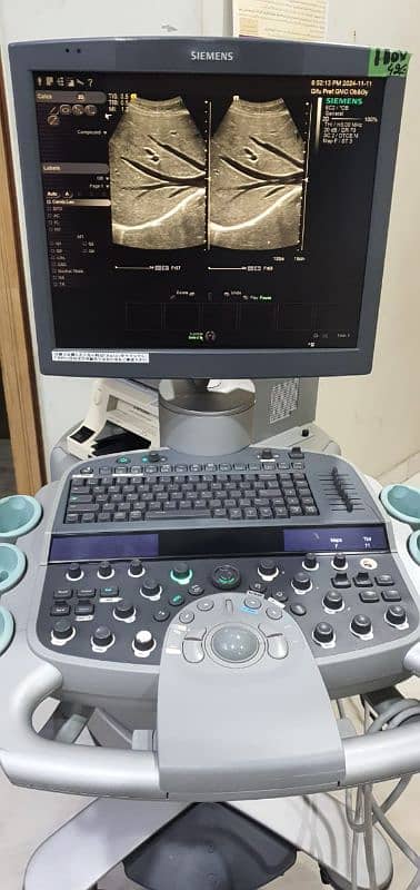 Ultrasound Machine 1