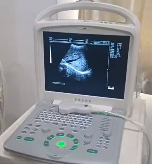 ultrasound machine / MEDAS MEDICAL SUPPLIERS / New year offers 2