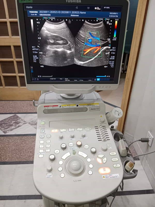 Xario 100/200 ultrasound machine available for sale. 2