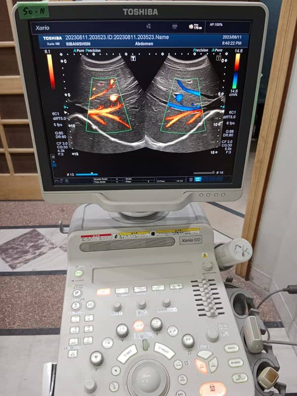 Xario 100/200 ultrasound machine available for sale. 4