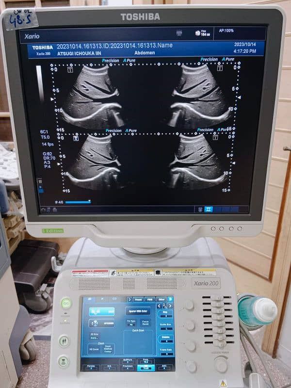 Xario 100/200 ultrasound machine available for sale. 10