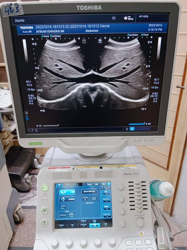 Xario 100/200 ultrasound machine available for sale. 11