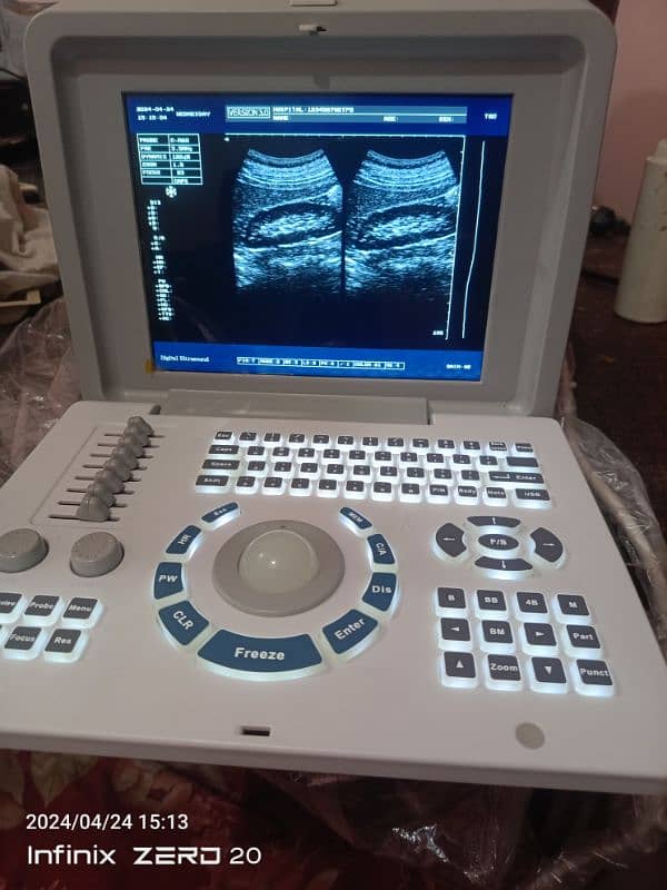 Ultrasound Machine 17