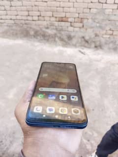 Redme note 11