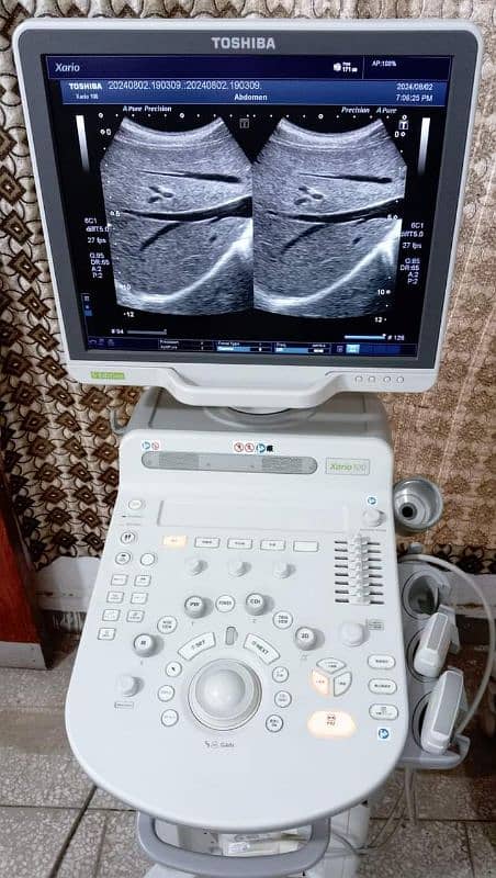 ALL TYPES OF ULTRASOUND MACHINES AVAILABLE FOR SALE 12