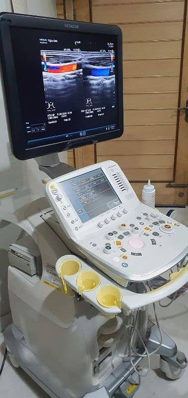 Ultrasound Machine 2