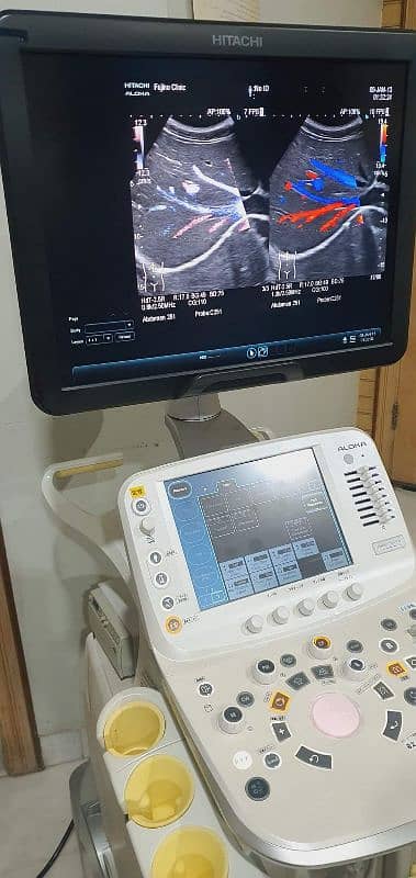 Ultrasound Machine 3