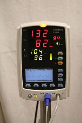 Cardiac Monitor for Sale | ICU Monitors | OT Monitors Patient monitor 4