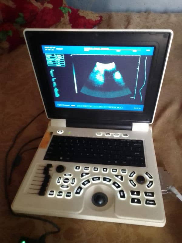 Orial Notbook Ultrasound For Sale Lush Condition 1