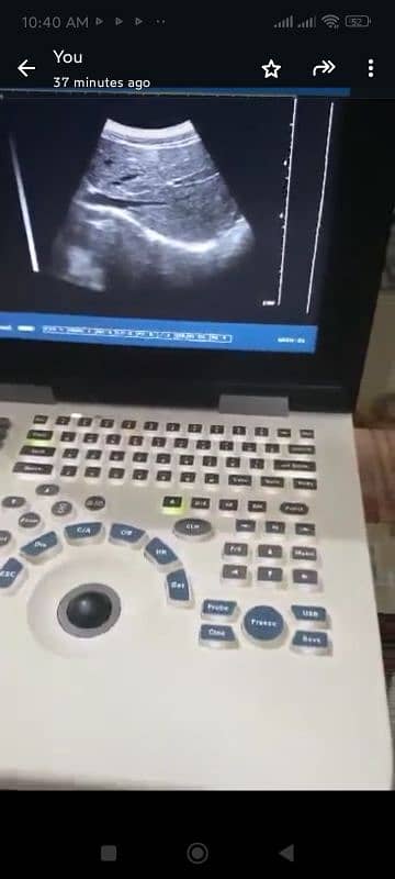 use nyro 10 ultrasound machine 2