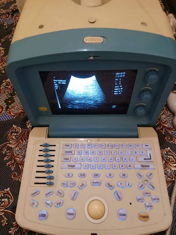 Ultrasound machine Sonofine Japan 2