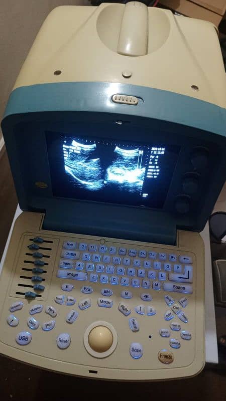 Ultrasound machine Sonofine Japan 3