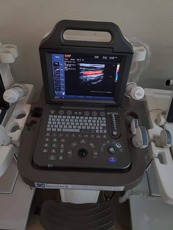 Colour dopplar ultrasound machine hi colour dopplar  ultrasound 0