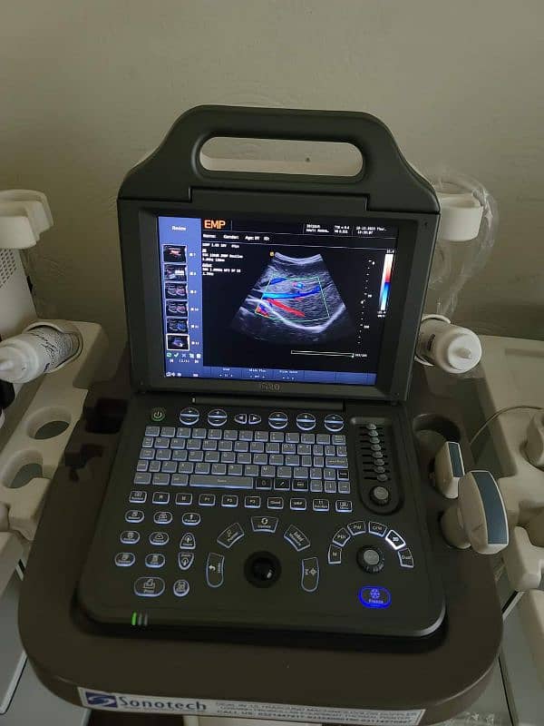 Colour dopplar ultrasound machine hi colour dopplar  ultrasound 5