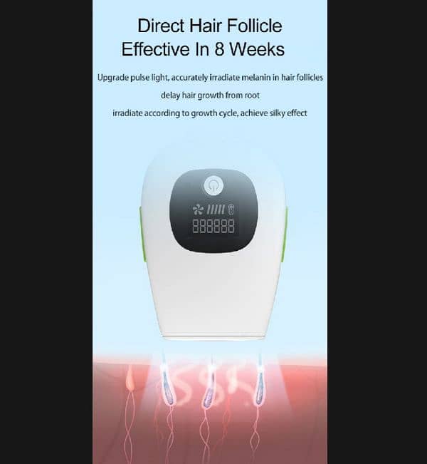 pixie professional laser epilator. laser hair removal 2