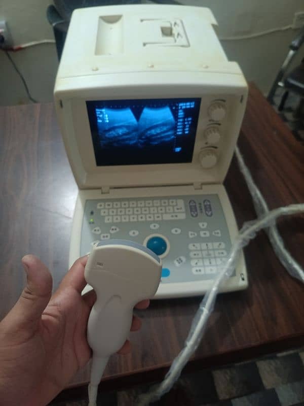 Japanese & China Ultrasound Machine 16