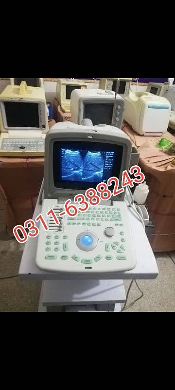 Japanese & China Ultrasound Machine 17