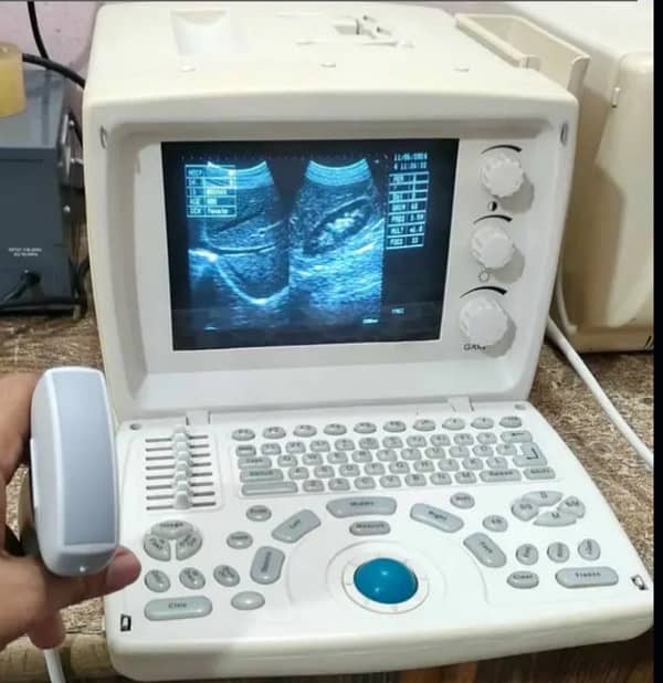 single handed used ultrasound machine 0