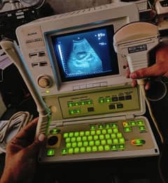 ultrasound machine with two probes tvs and convex Aloka