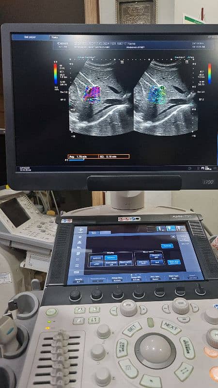 Aplio i700 ultrasound machine 6