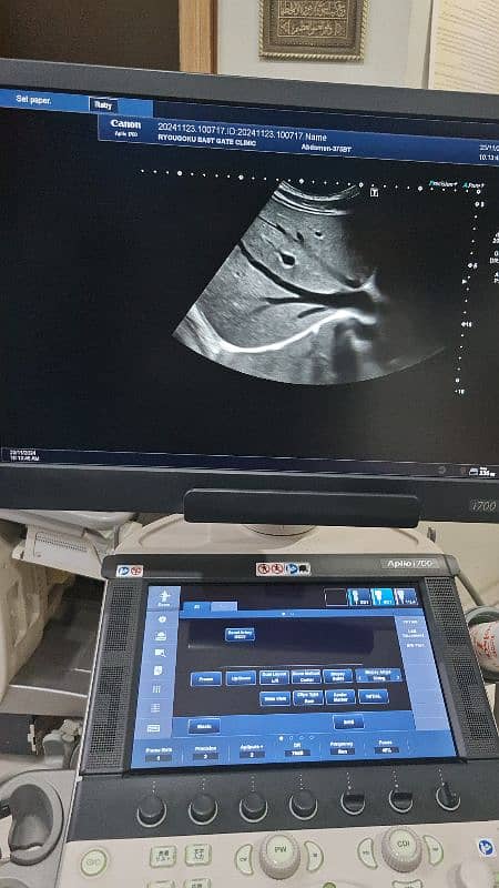 Aplio i700 ultrasound machine 7