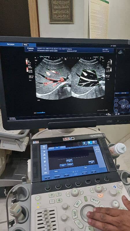 Aplio i700 ultrasound machine 8