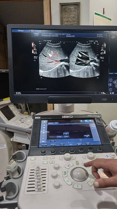 Aplio i700 ultrasound machine 9