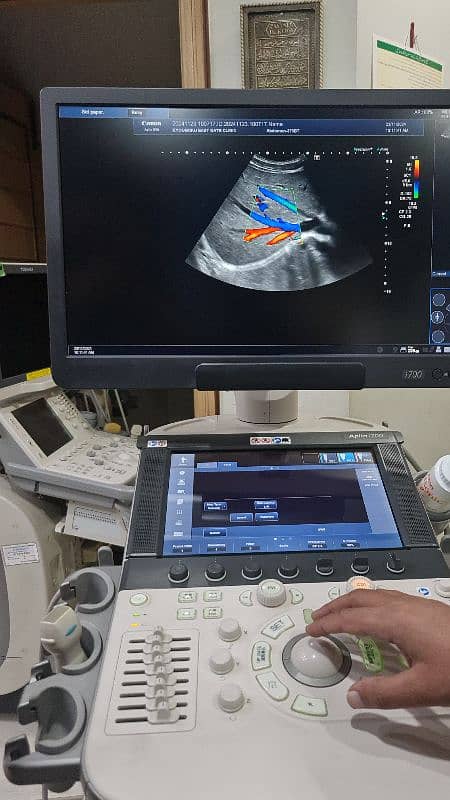 Aplio i700 ultrasound machine 11