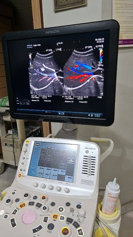 Fujifilm Hitachi Arieta 50/60 ultrasound machine. 5