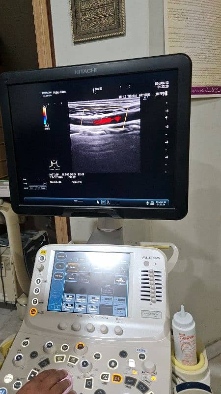 Fujifilm Hitachi Arieta 50/60 ultrasound machine. 6