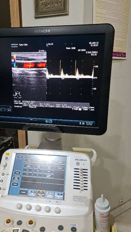 Fujifilm Hitachi Arieta 50/60 ultrasound machine. 8