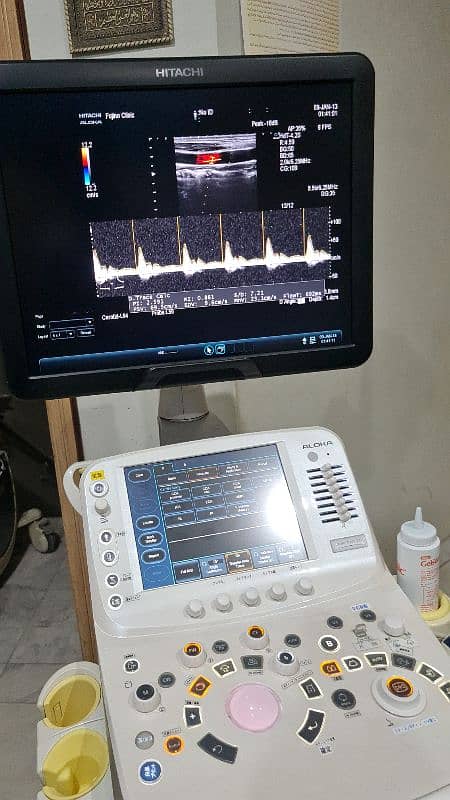 Fujifilm Hitachi Arieta 50/60 ultrasound machine. 9