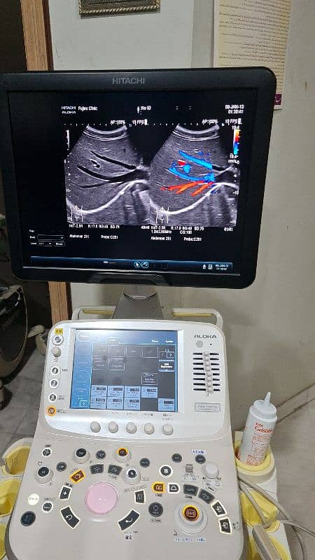 Fujifilm Hitachi Arieta 50/60 ultrasound machine. 10