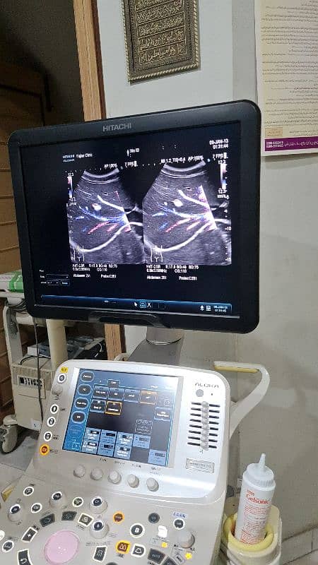 Fujifilm Hitachi Arieta 50/60 ultrasound machine. 11