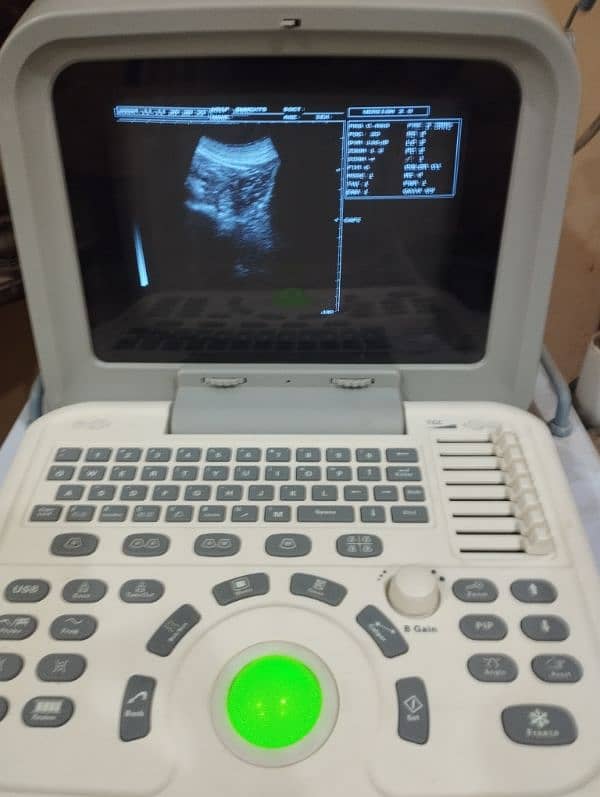 Complete Set Ultrasound Machine+Probe+Trolley+Stabilizer 1