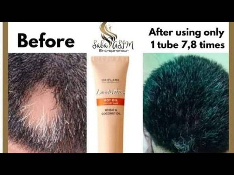 Hot Oil for hair growth 1