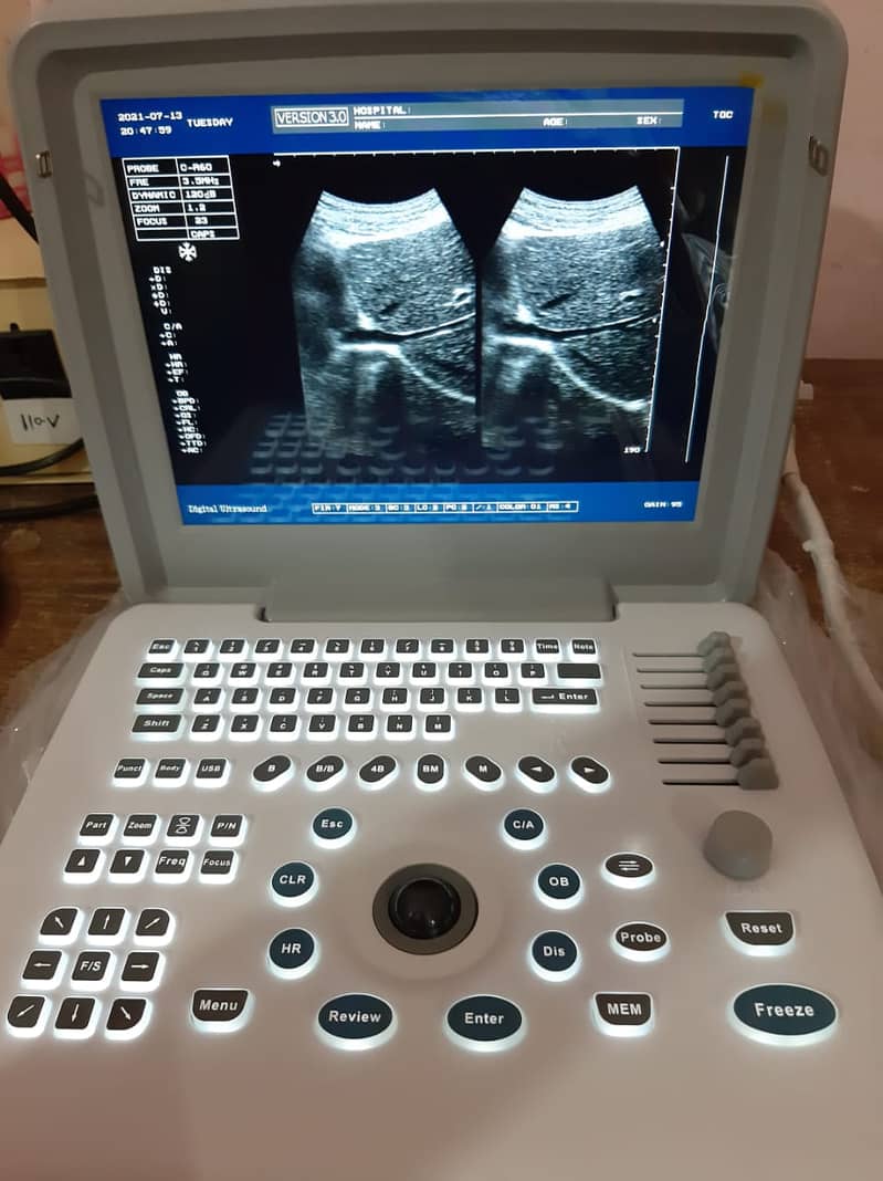 Brand new Ultrasound machine Chinese (with or without battery backup) 4