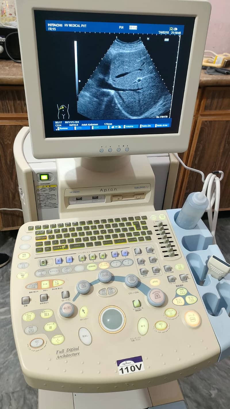 Refurb japaense color Doppler  portable & trolley mounted ultrasound m 4