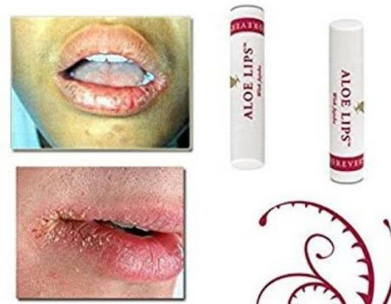 Aloe Lips 1