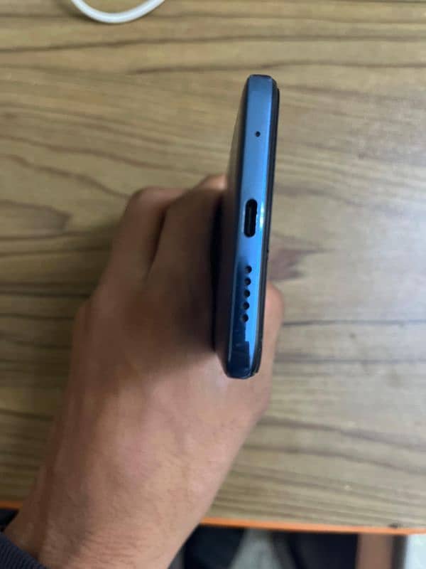 Xiaomi Redmi Note 11 6